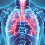 التهاب مجاری تنفسی چیست؟