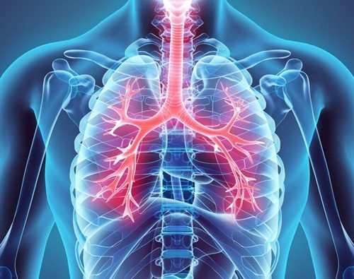 التهاب مجاری تنفسی چیست؟