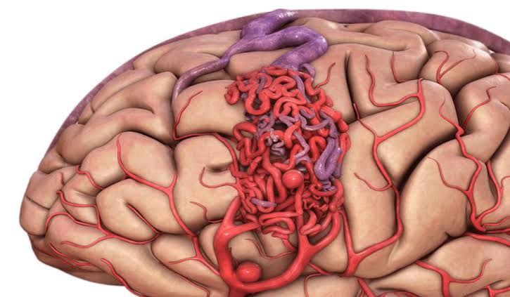 مدیریت عوامل خطر و درمان دارویی